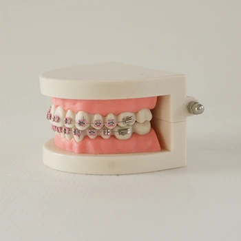 Dental Modelo de Ensino Ortho Metal Brcker Dental Implantes Dentes Modelo para o Ensino